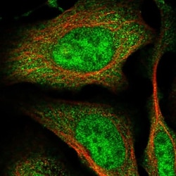 RNF126 Antibody, Novus Biologicals 0.1mL; Unlabeled:Antibodies, Polyclonal